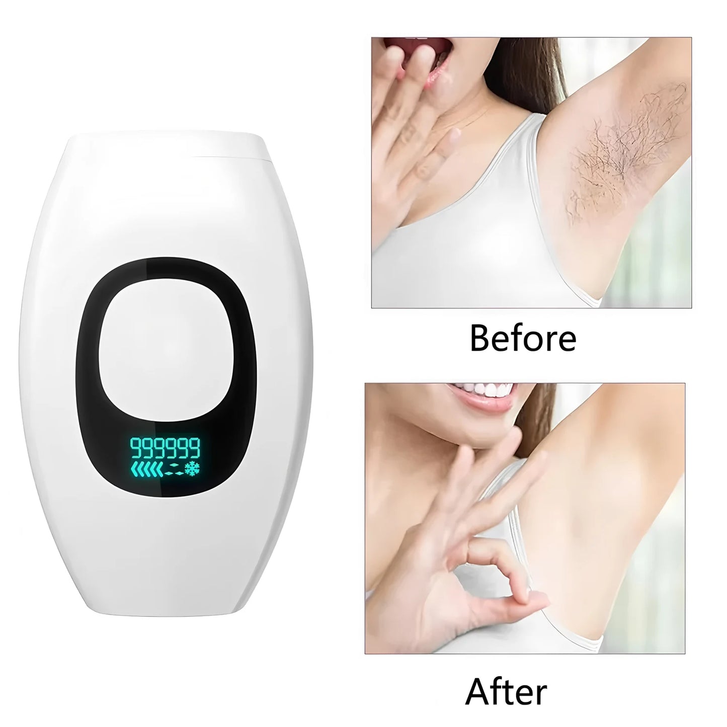 Electric IPL Laser Hair Removal Handset Professional Painless Depilator for Home Use