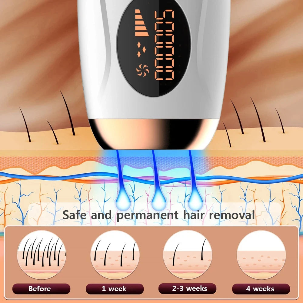 IPL Hair Removal Device 990,000 Flashes Painless Laser Epilator for Women Body & Face